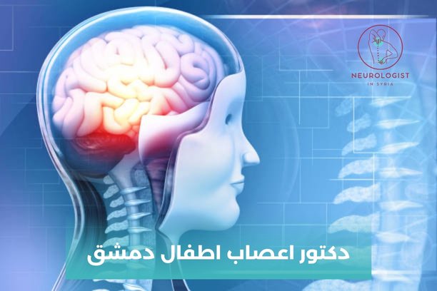 اشطر دكتور عصبية في دمشق