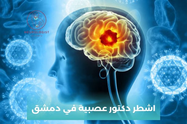 دكتور عصبية باب مصلى دكتور عصبية باب مصلى