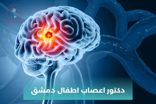 دكتور اعصاب اطفال دمشق