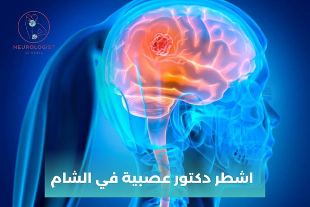 دكتور عصبية دمشق المزة