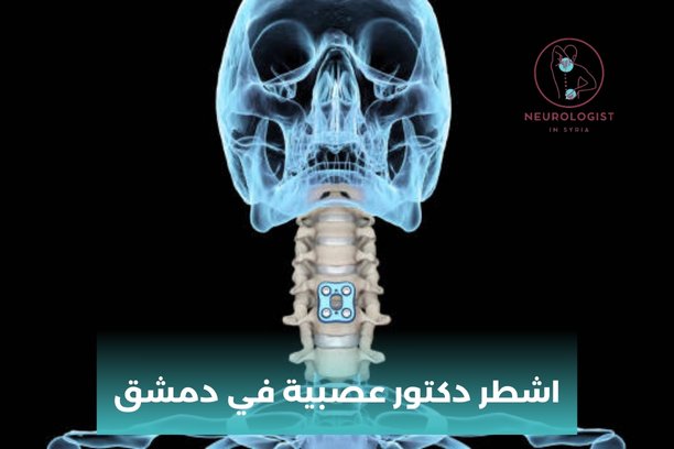 من هو اشطر دكتور عصبية في دمشق ؟ من هو اشطر دكتور عصبية في دمشق ؟