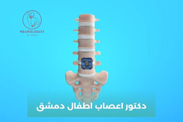 هل يمكن علاج الديسك دون عمل جراحي؟