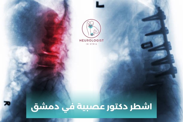 دكتور عصبية شارع بغداد دكتور عصبية شارع بغداد