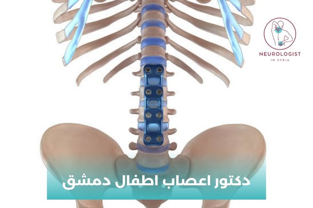 دكتور اعصاب في دمشق
