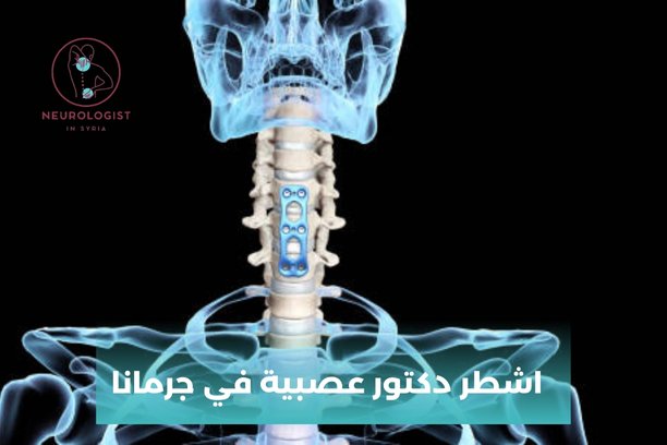 اشطر دكتور عصبية في دمشق