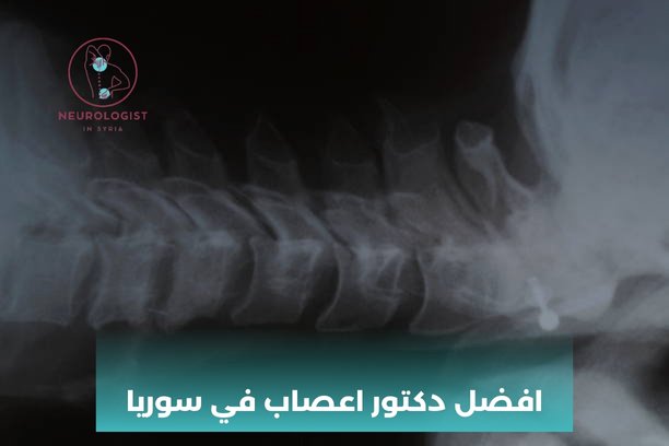 هل يمكن علاج استسقاء الدماغ عند الأطفال؟ هل يمكن علاج استسقاء الدماغ عند الأطفال؟