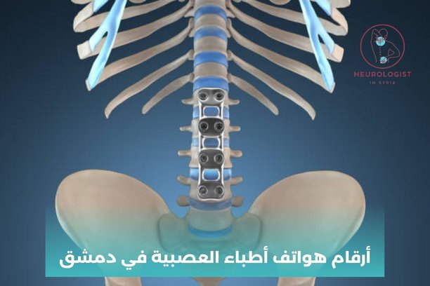 اشطر دكتور عصبية في جرمانا اشطر دكتور عصبية في جرمانا