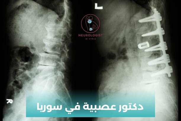ما هي المهارات اللازمة لوظيفة دكتور عصبية في سوريا؟