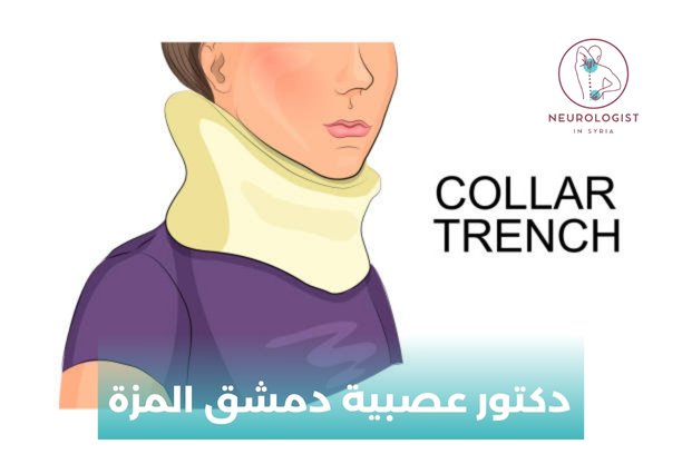 دكتور عصبية شارع بغداد