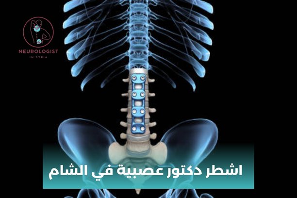 ارقام أطباء عصبية في دمشق