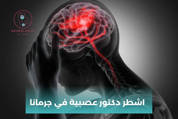 دكتور عصبية بالشام