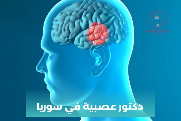 دكتور عصبية في سوريا