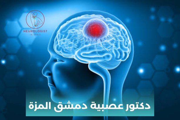 من هو أفضل دكتور عصبية في دمشق؟