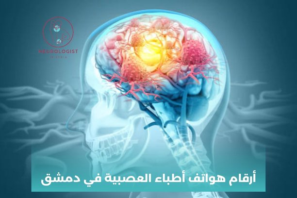 دكتور عصبية شارع بغداد دكتور عصبية شارع بغداد