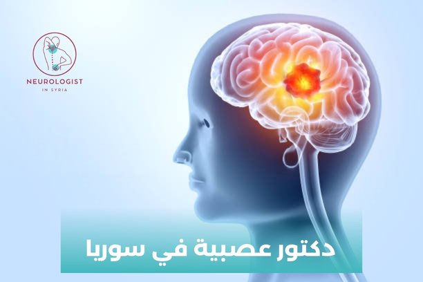 اشطر دكتور عصبية في دمشق