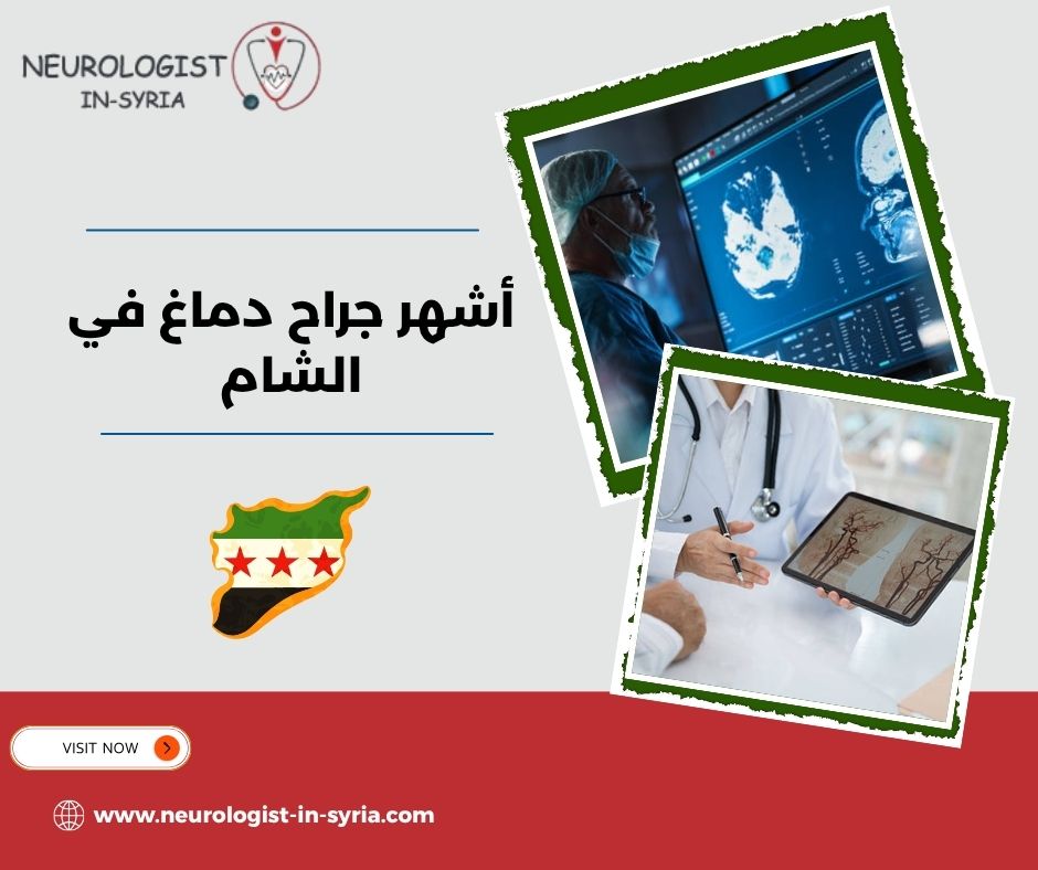 أشهر جراح دماغ في الشام