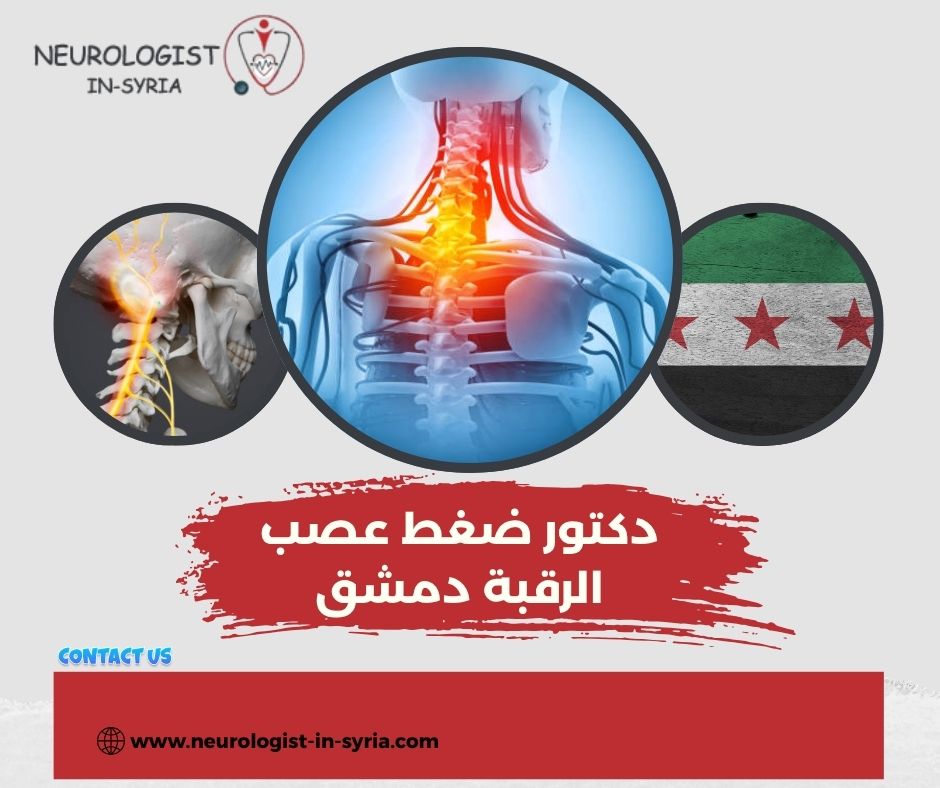 دكتور ضغط عصب الرقبة دمشق