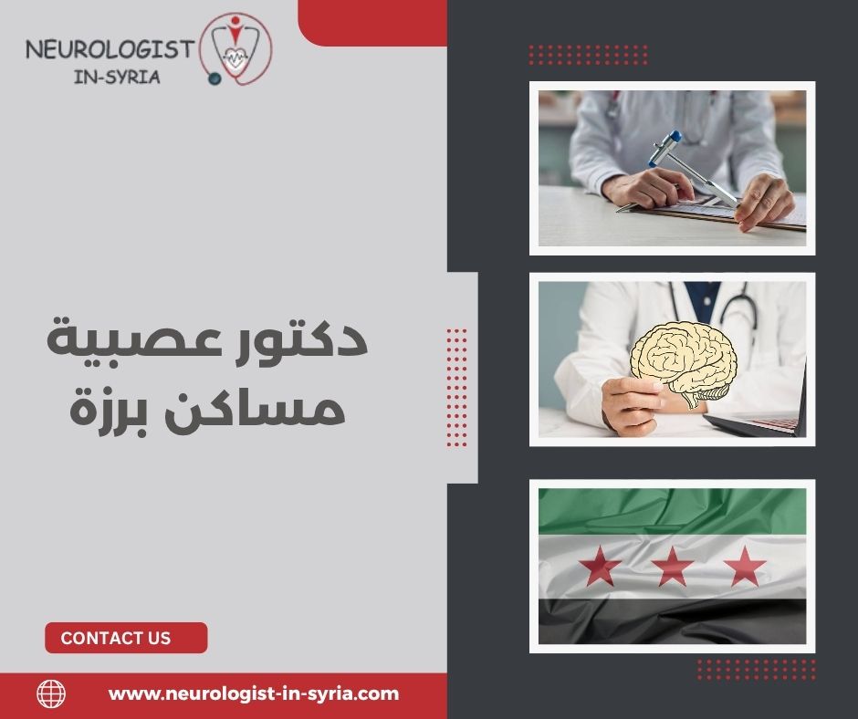 دكتور عصبية مساكن برزة
