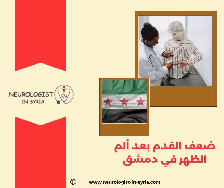 ضعف القدم بعد ألم الظهر في دمشق