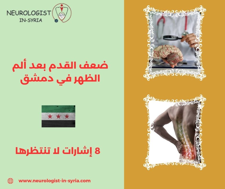 ضعف القدم بعد ألم الظهر في دمشق