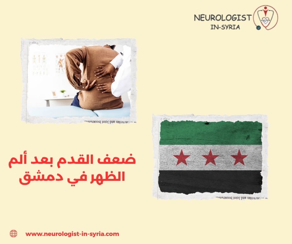 ضعف القدم بعد ألم الظهر في دمشق