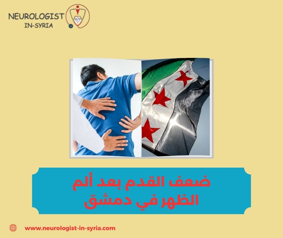 ضعف القدم بعد ألم الظهر في دمشق