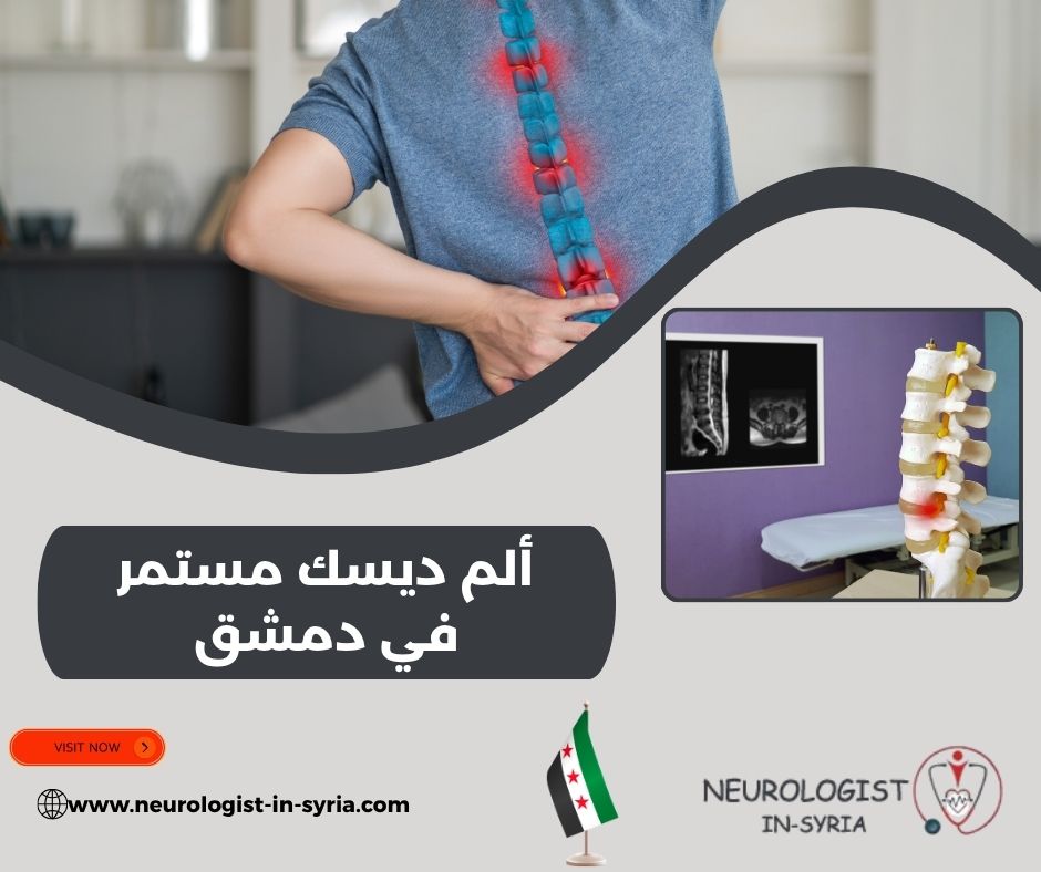 ألم ديسك مستمر في دمشق