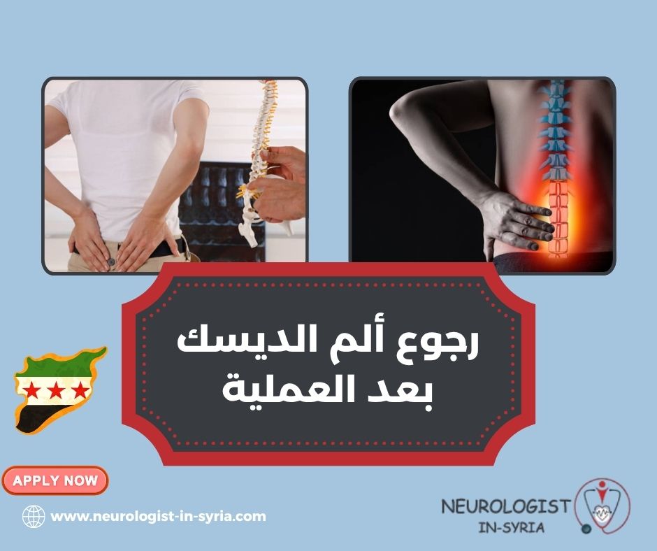 رجوع ألم الديسك بعد العملية