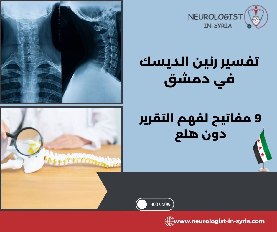 تفسير رنين الديسك في دمشق