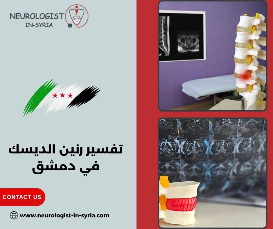 تفسير رنين الديسك في دمشق