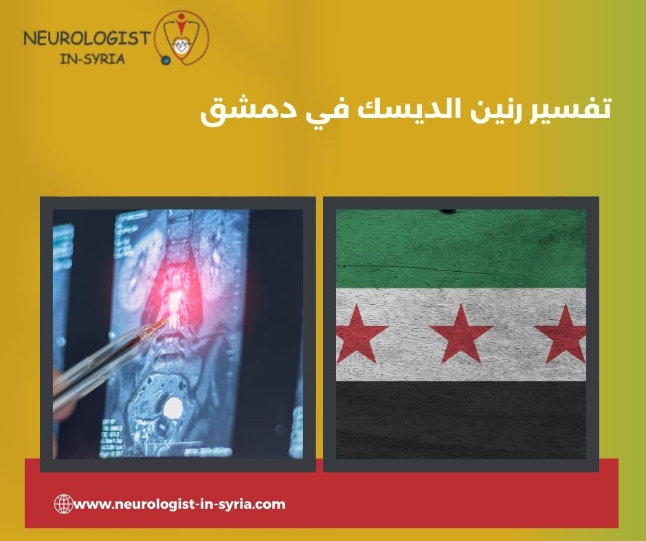 تفسير رنين الديسك في دمشق
