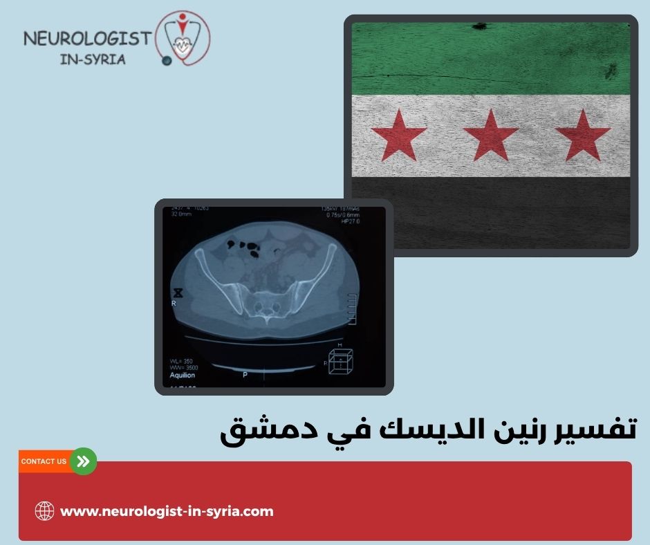 تفسير رنين الديسك في دمشق