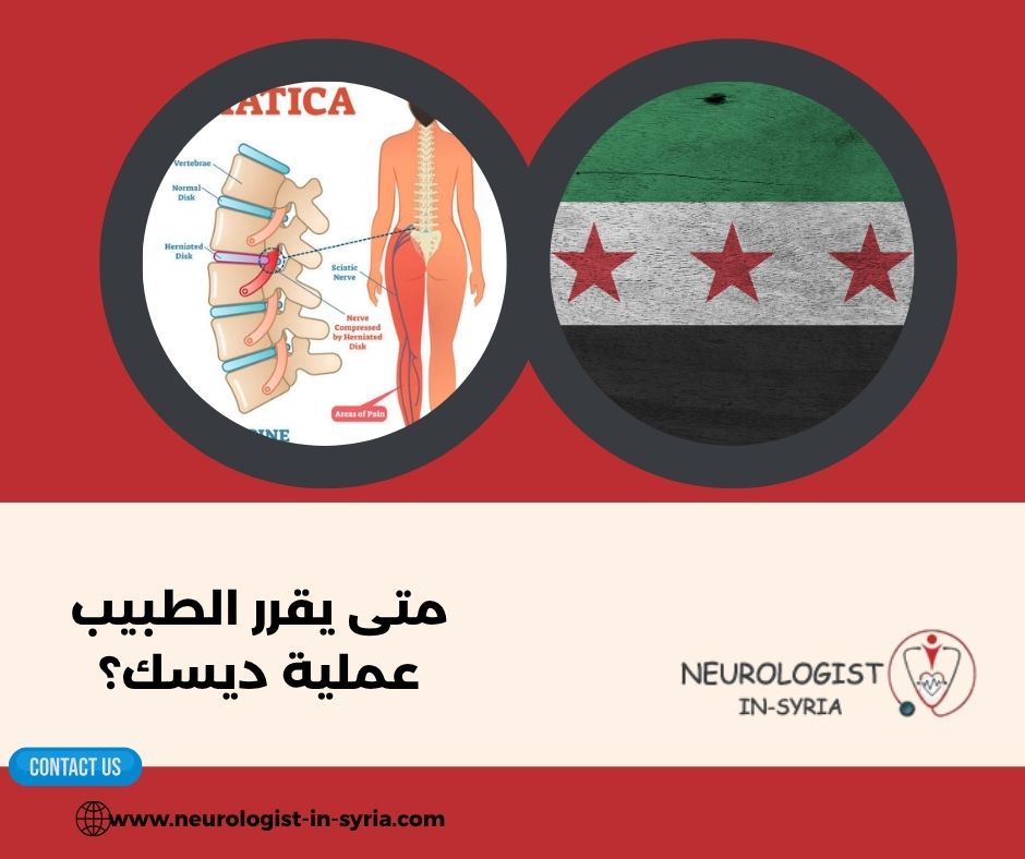 متى يقرر الطبيب عملية ديسك؟