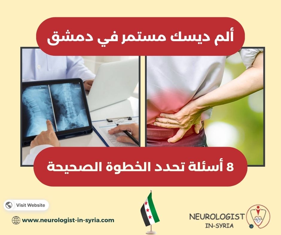 ألم ديسك مستمر في دمشق