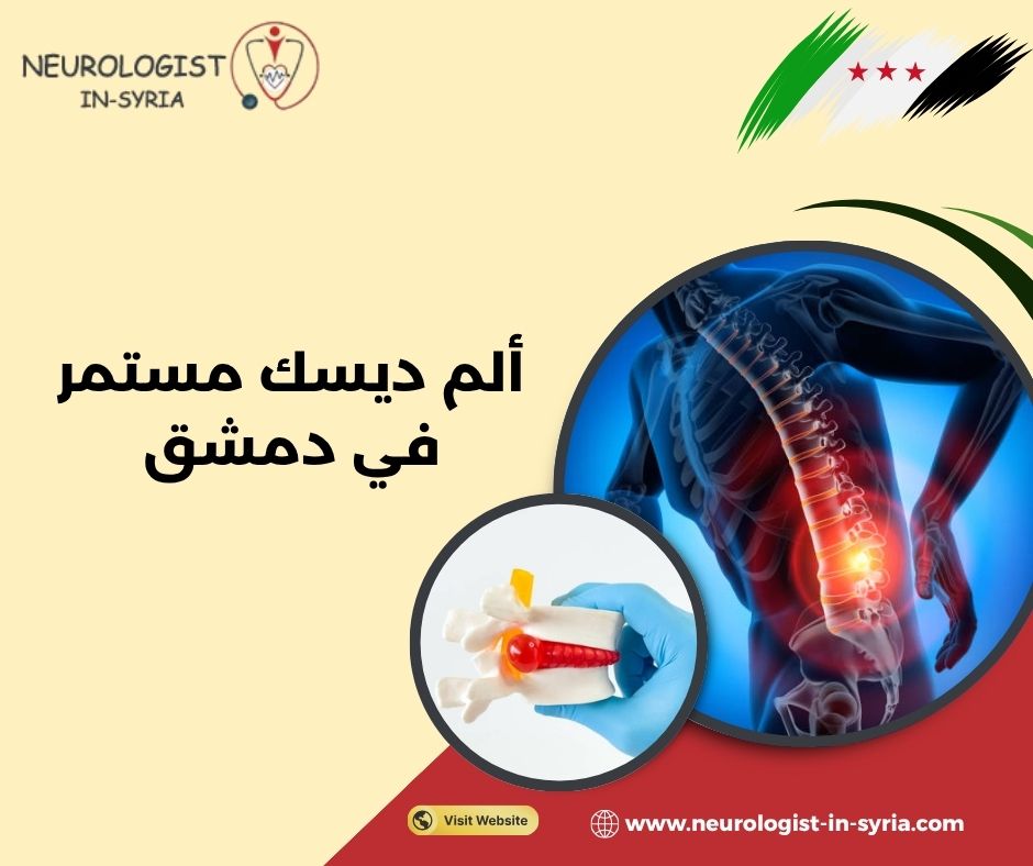 ألم ديسك مستمر في دمشق