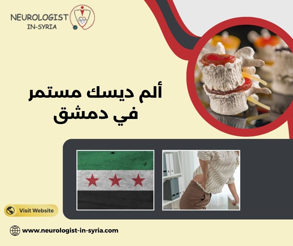 ألم ديسك مستمر في دمشق