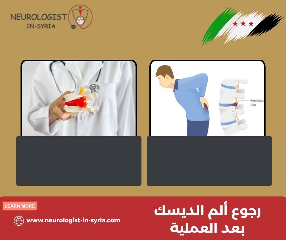 رجوع ألم الديسك بعد العملية