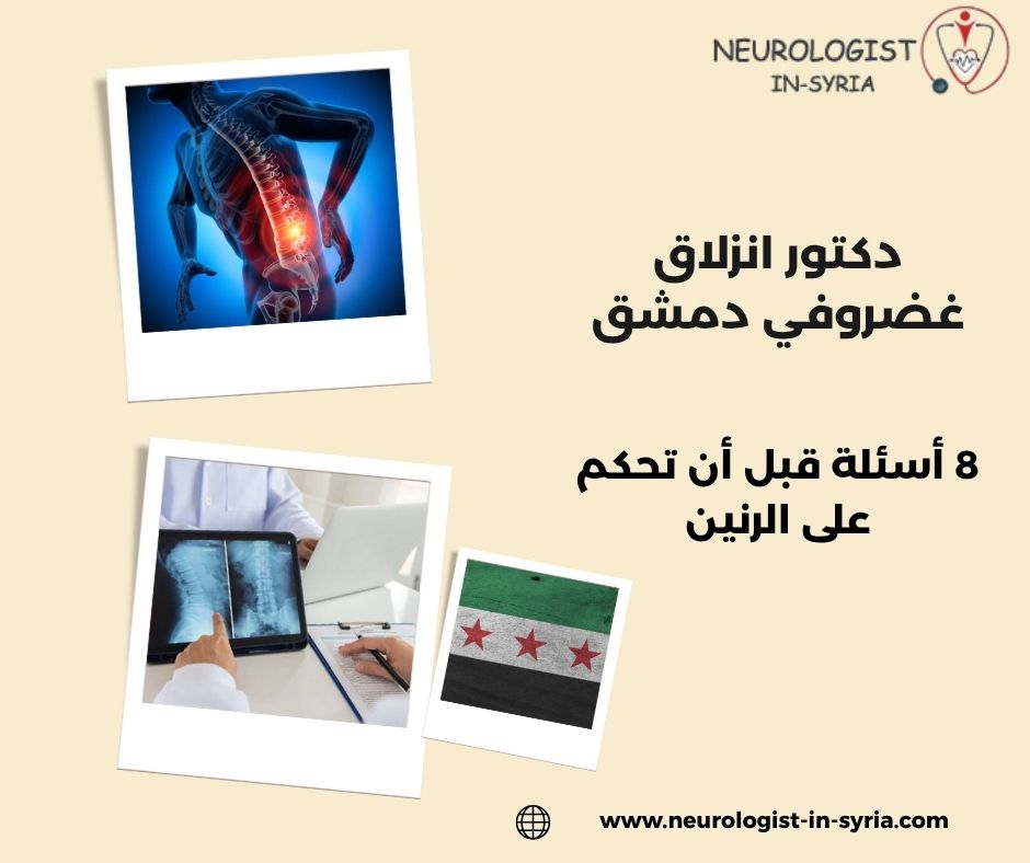دكتور انزلاق غضروفي دمشق