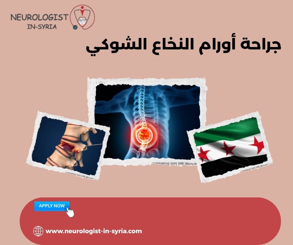 جراحة أورام النخاع الشوكي
