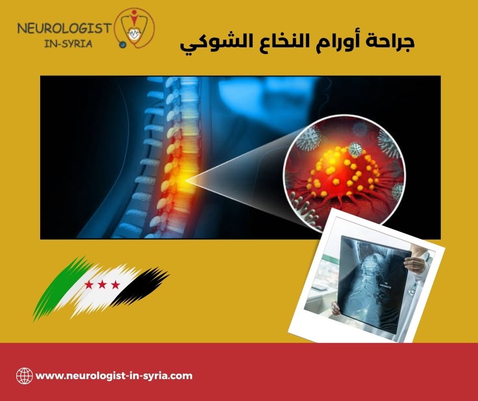 جراحة أورام النخاع الشوكي