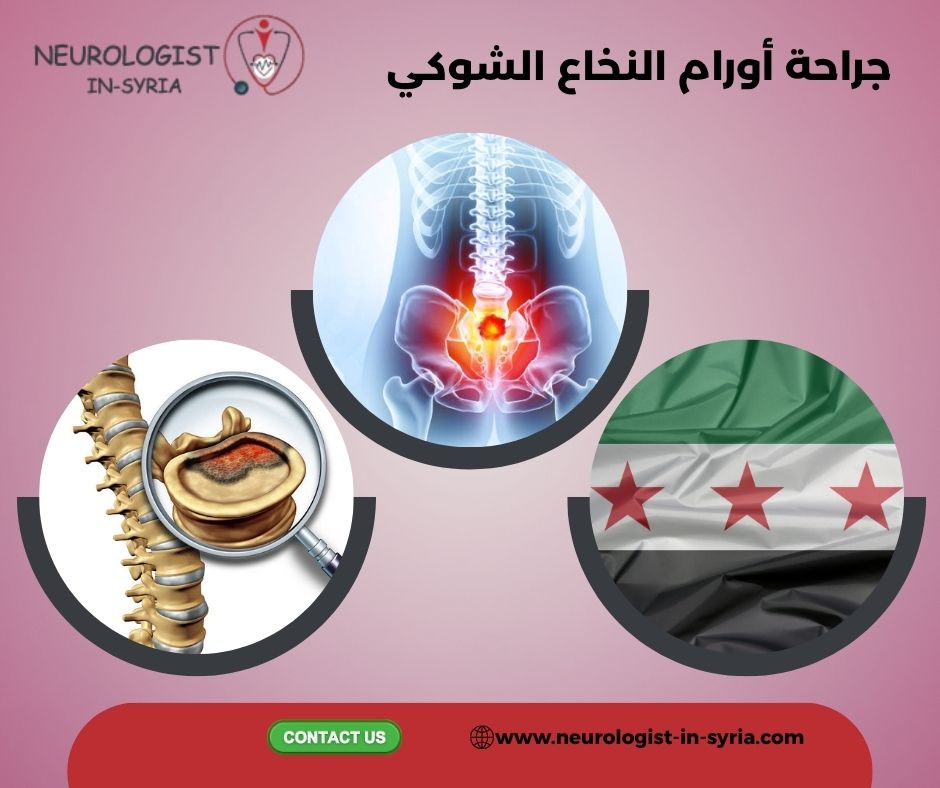 جراحة أورام النخاع الشوكي