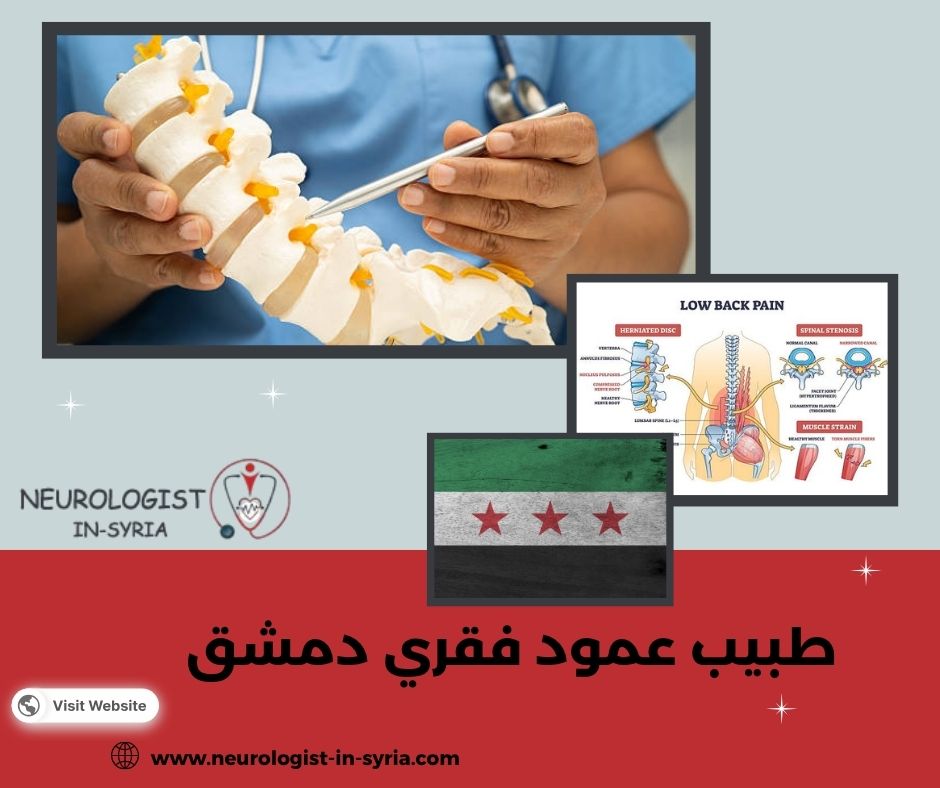 طبيب عمود فقري دمشق
