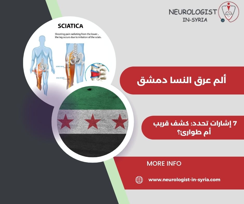 ألم عرق النسا دمشق