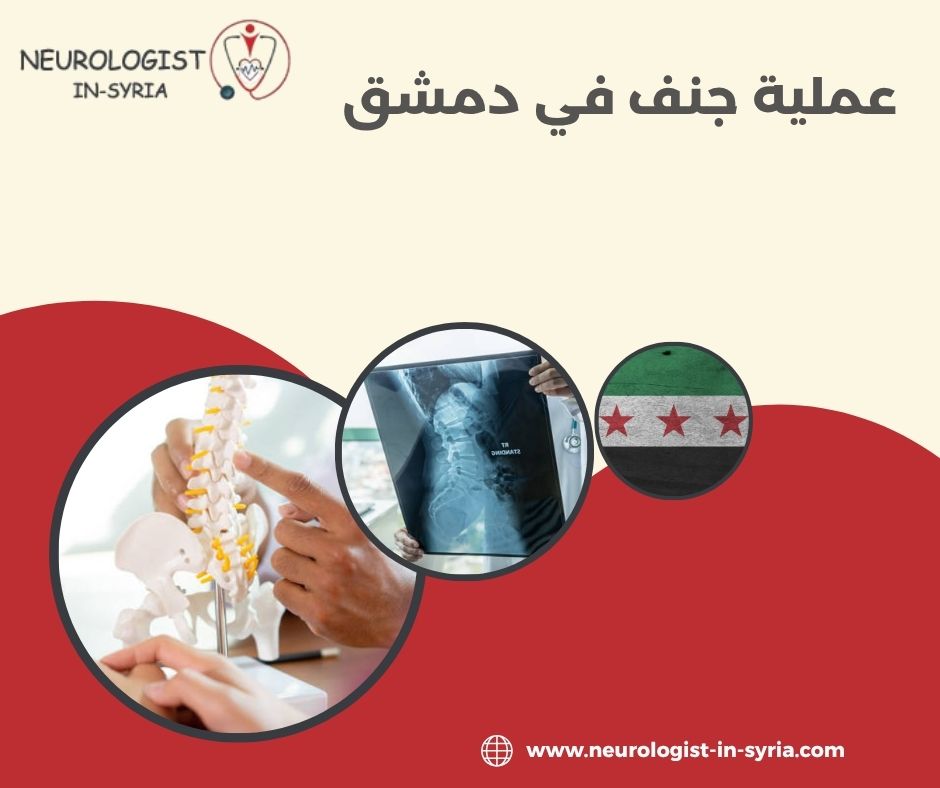 عملية جنف في دمشق