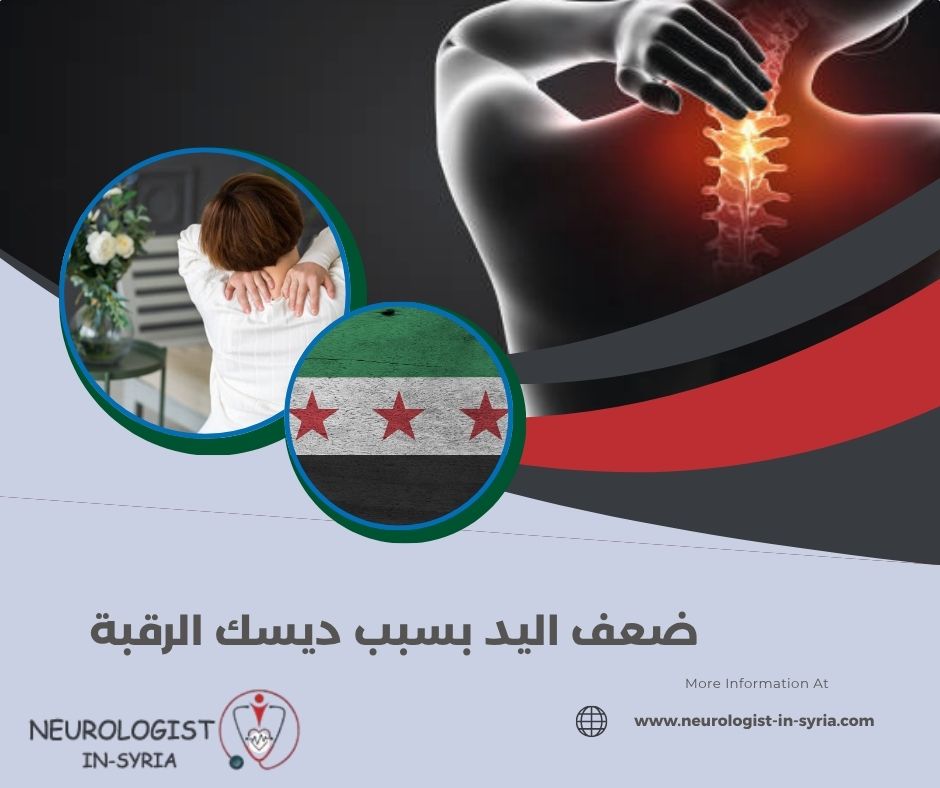 ضعف اليد بسبب ديسك الرقبة
