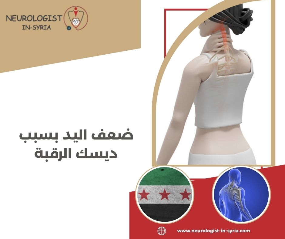 ضعف اليد بسبب ديسك الرقبة