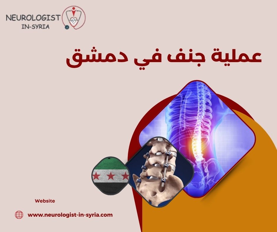 عملية جنف في دمشق