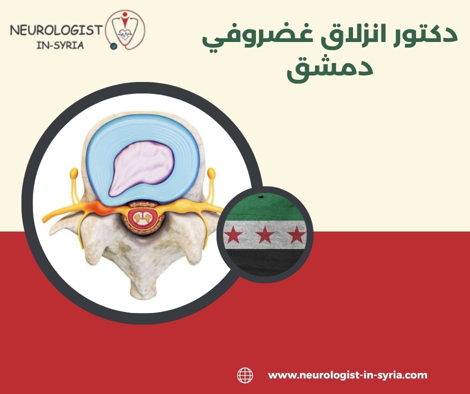 دكتور انزلاق غضروفي دمشق