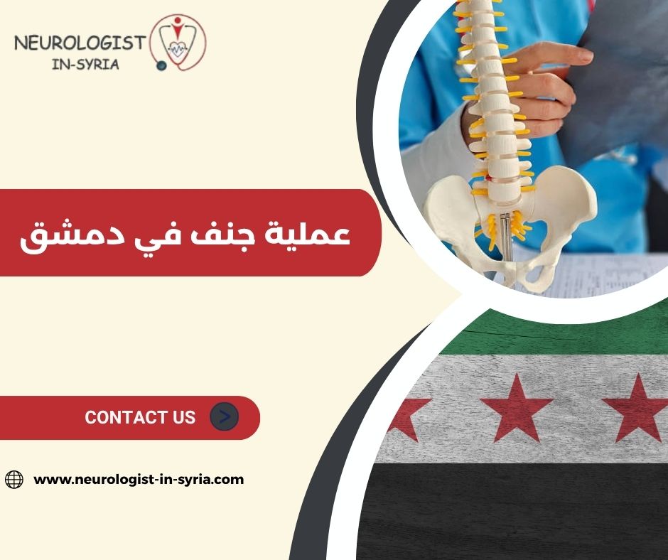 عملية جنف في دمشق