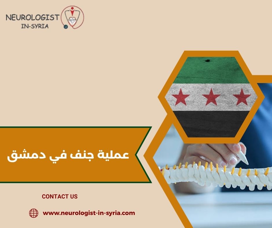 عملية جنف في دمشق